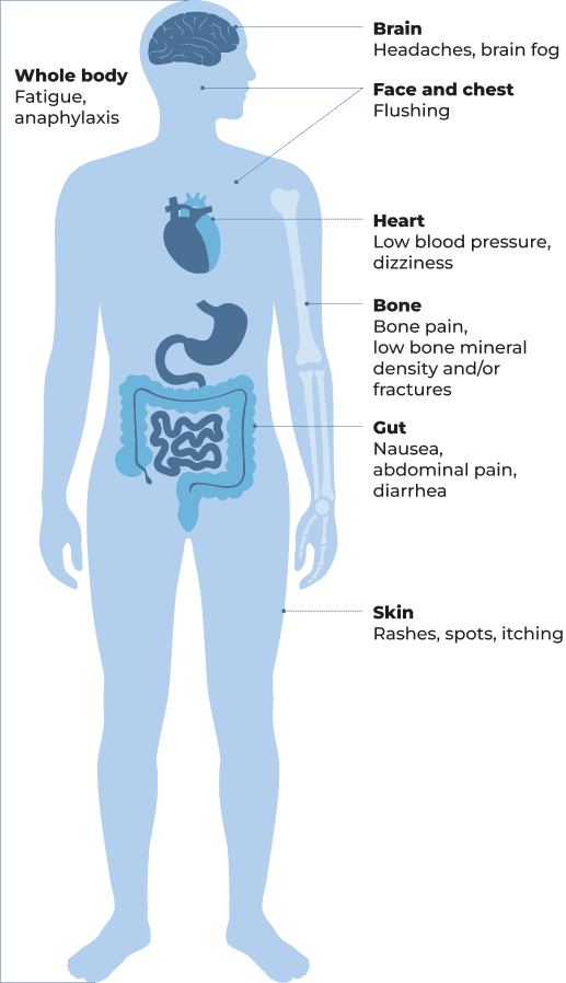 Illustration of a person highlighting body areas affected by ISM symptoms.